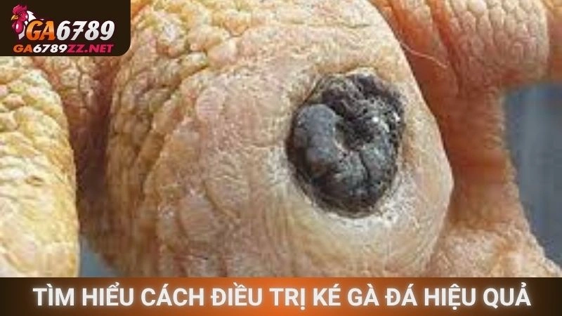 Tìm hiểu cách điều trị ké gà đá hiệu quả