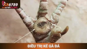 Điều Trị Ké Gà Đá