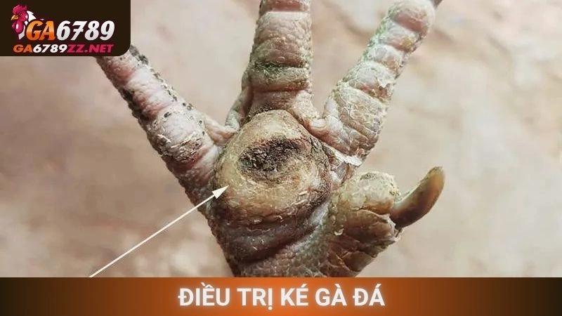 Điều Trị Ké Gà Đá