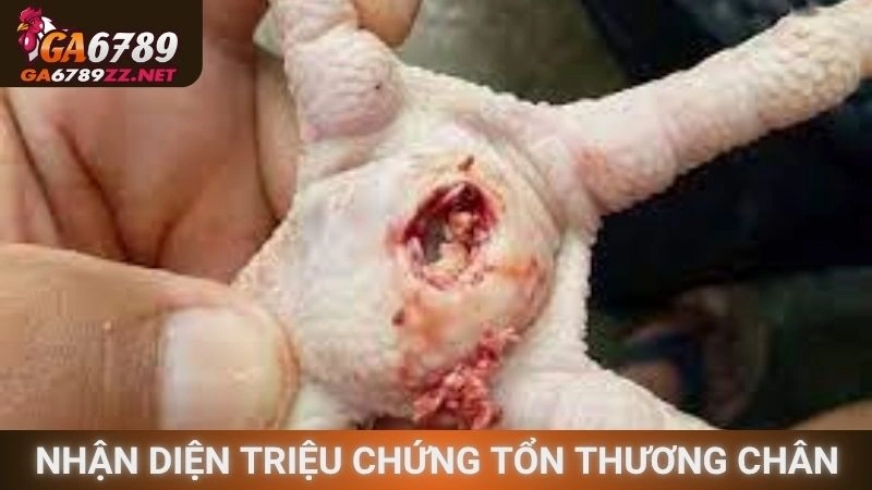 Nhận diện các triệu chứng tổn thương chân