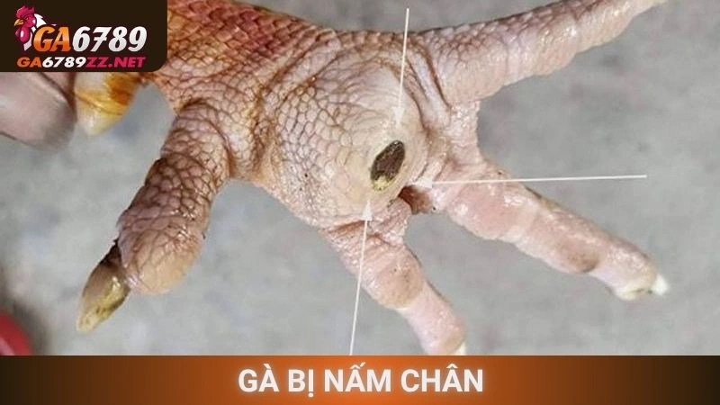 Gà Bị Nấm Chân